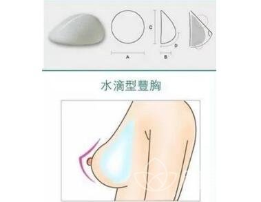 麦格乳房假体价位是多少?受什么因素的影响