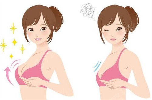 【隆胸日记】娜高乳房假体隆胸后三个月胸部就灰常柔软了