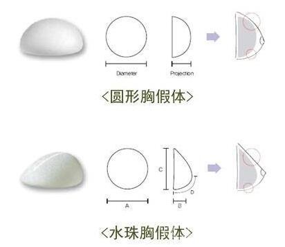 在做假体隆胸之前，你需要考虑以下因素