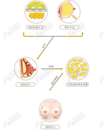 自体脂肪填充维持多久？自体脂肪填充的维持时间有多长